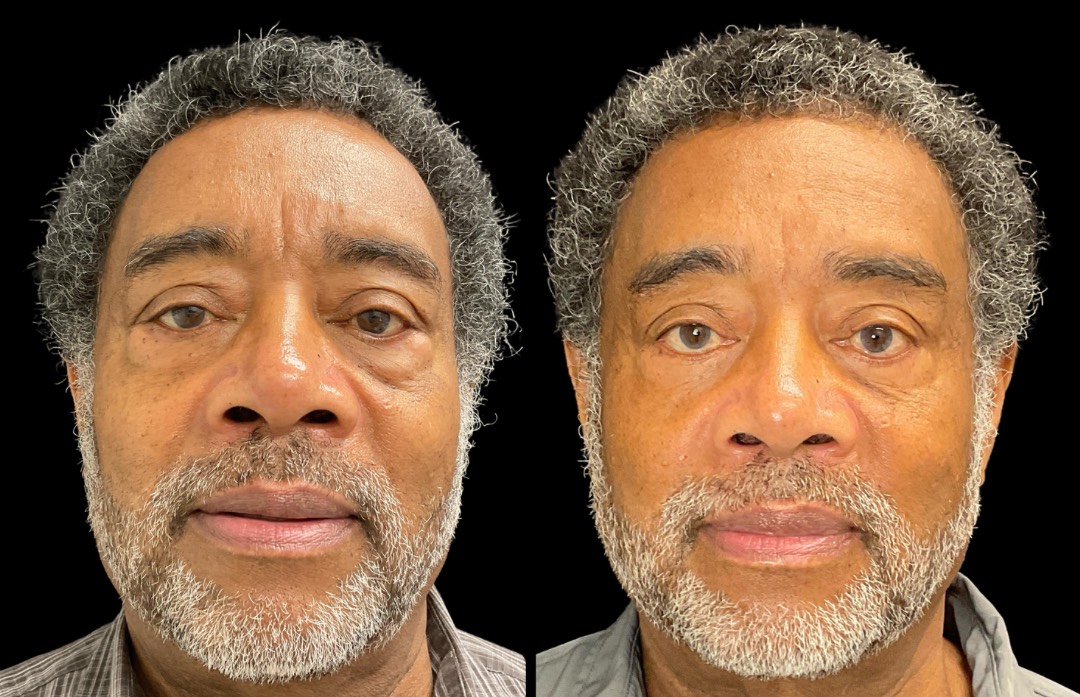 Copy of Untitled Design – 1