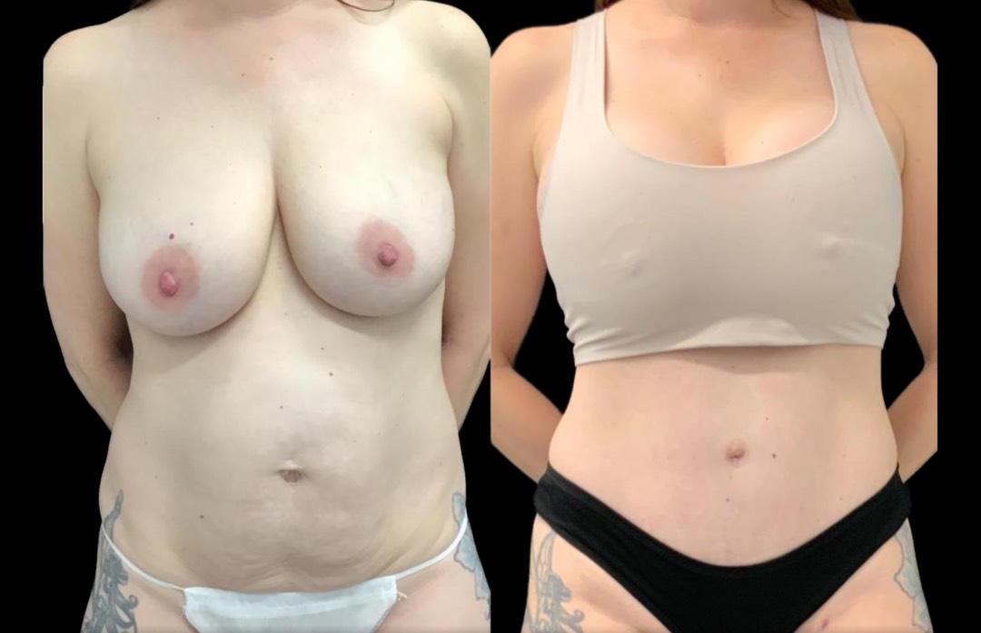 Copy of Untitled Design – 1