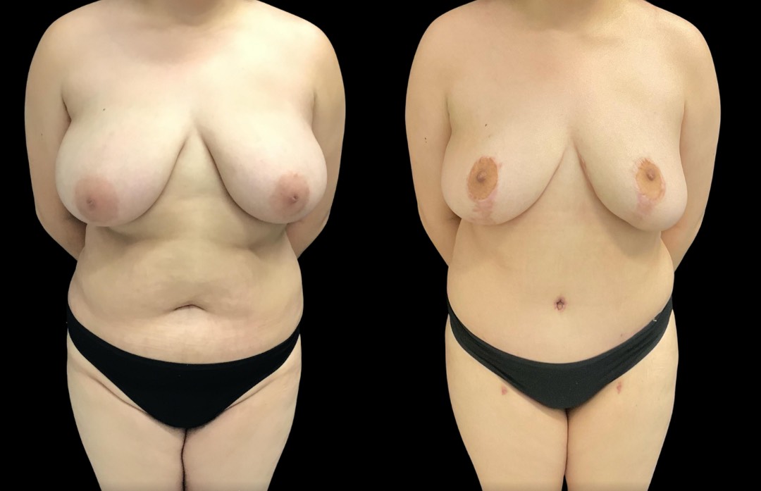 Copy of Untitled Design – 1