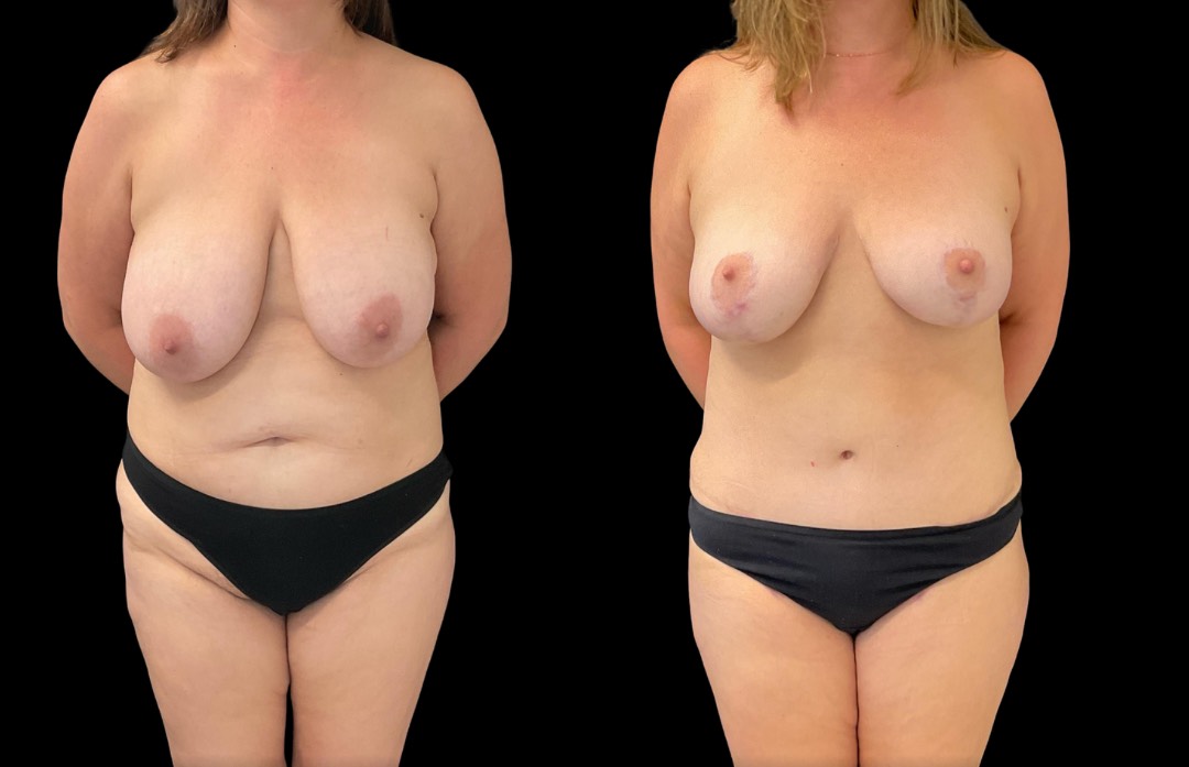 Copy of Untitled Design – 1