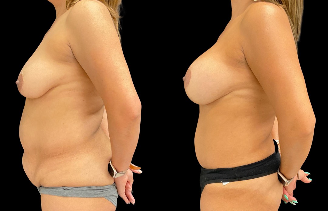 Copy of Untitled Design – 1