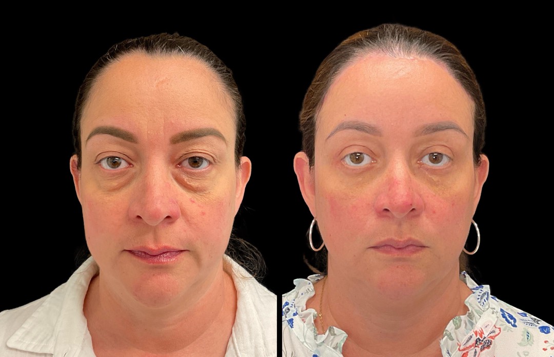 Copy of Untitled Design – 1