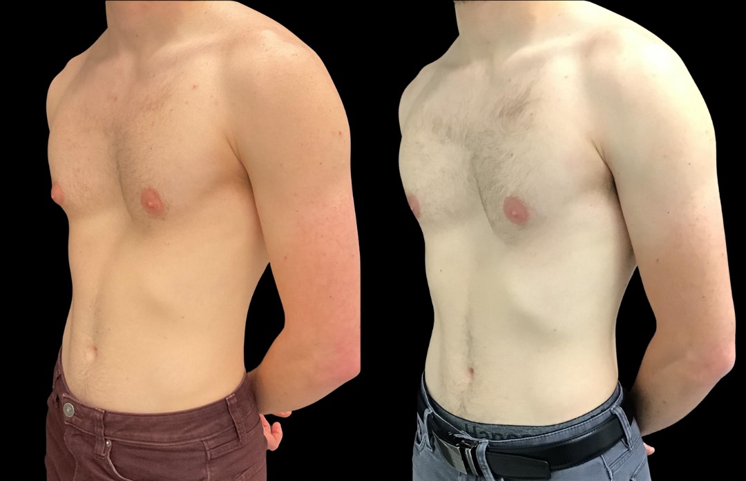 Copy of Untitled Design – 2 (1)