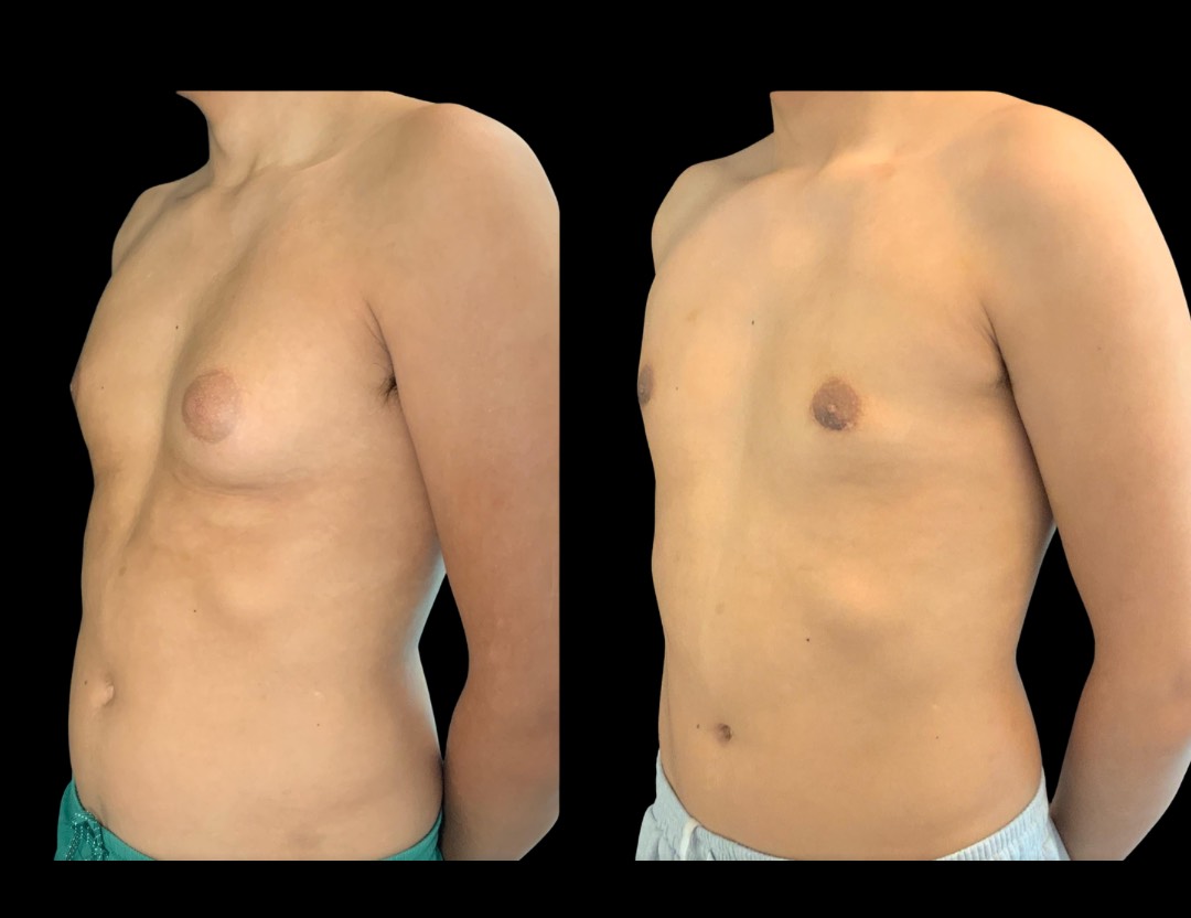 Copy of Untitled Design – 2 (1)