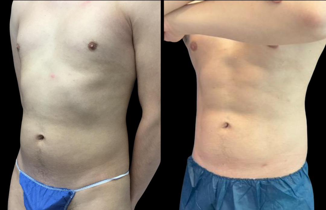 Copy of Untitled Design – 2