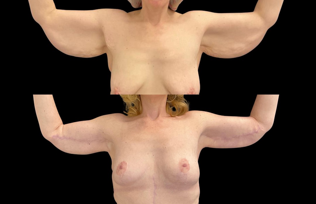 Copy of Untitled Design – 2