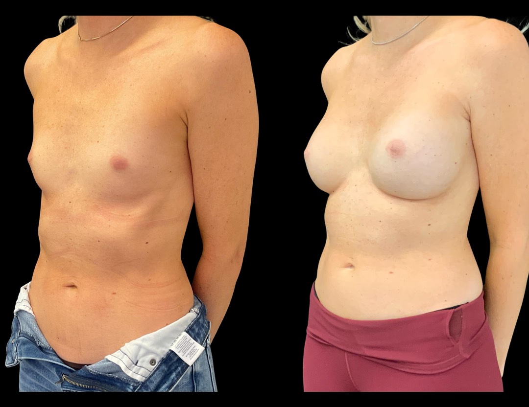 Copy of Untitled Design – 2