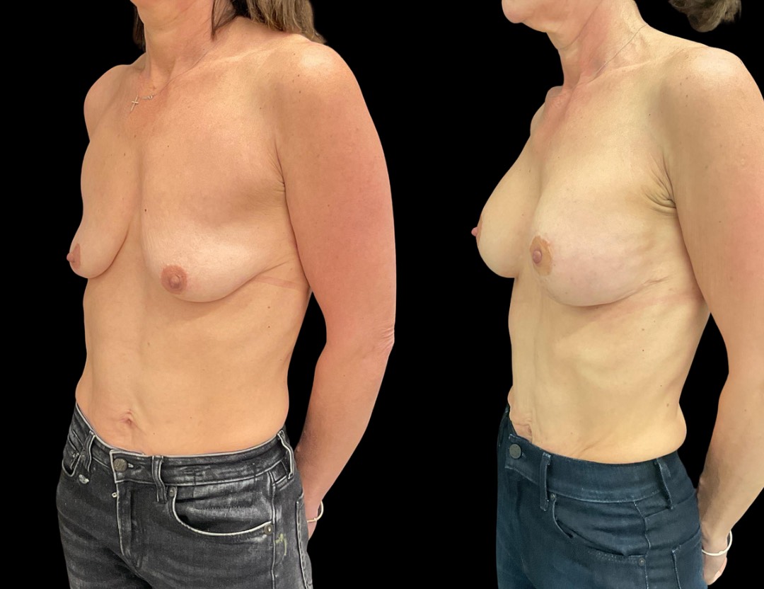 Copy of Untitled Design – 2