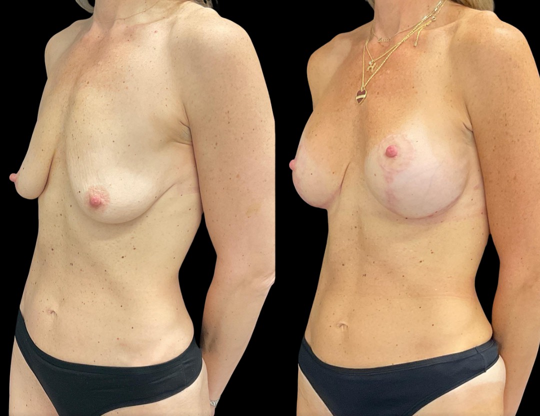 Copy of Untitled Design – 2