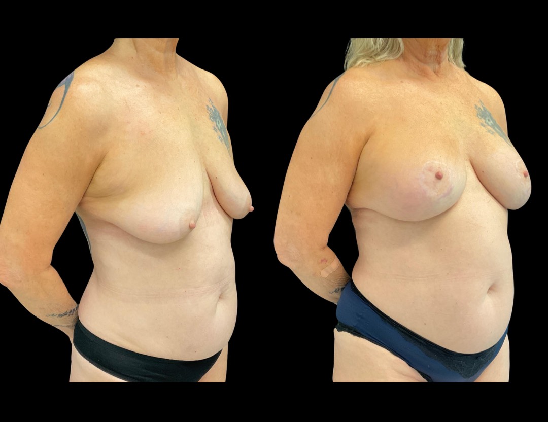 Copy of Untitled Design – 2