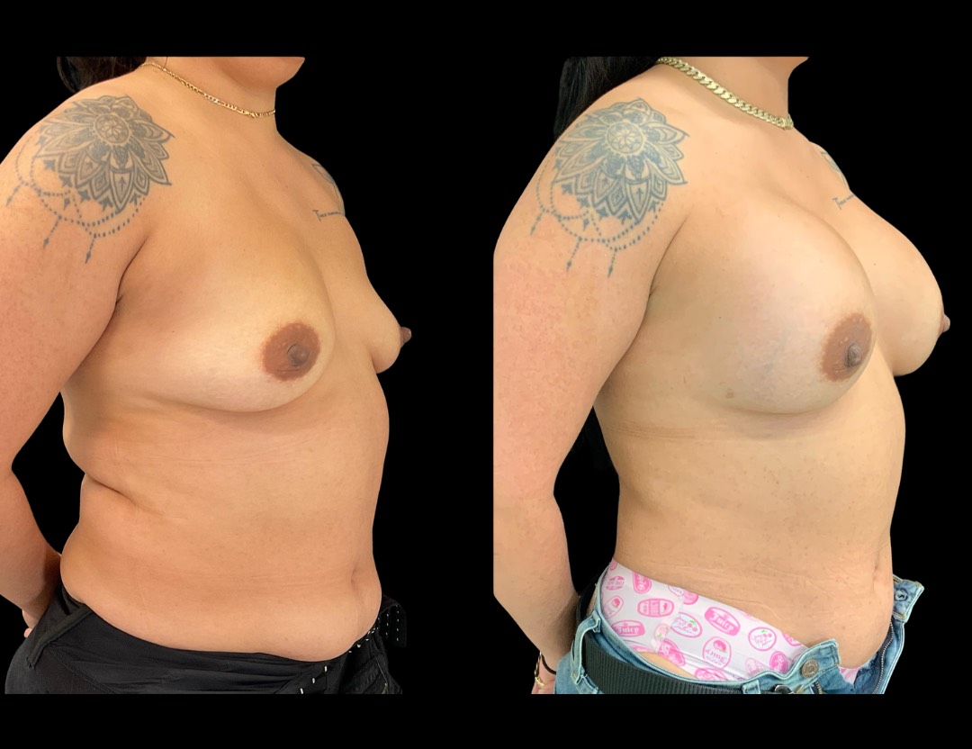 Copy of Untitled Design – 2