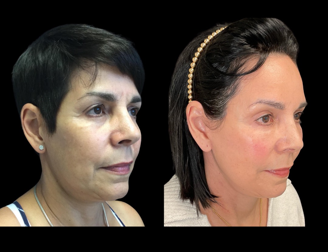 Copy of Untitled Design – 2