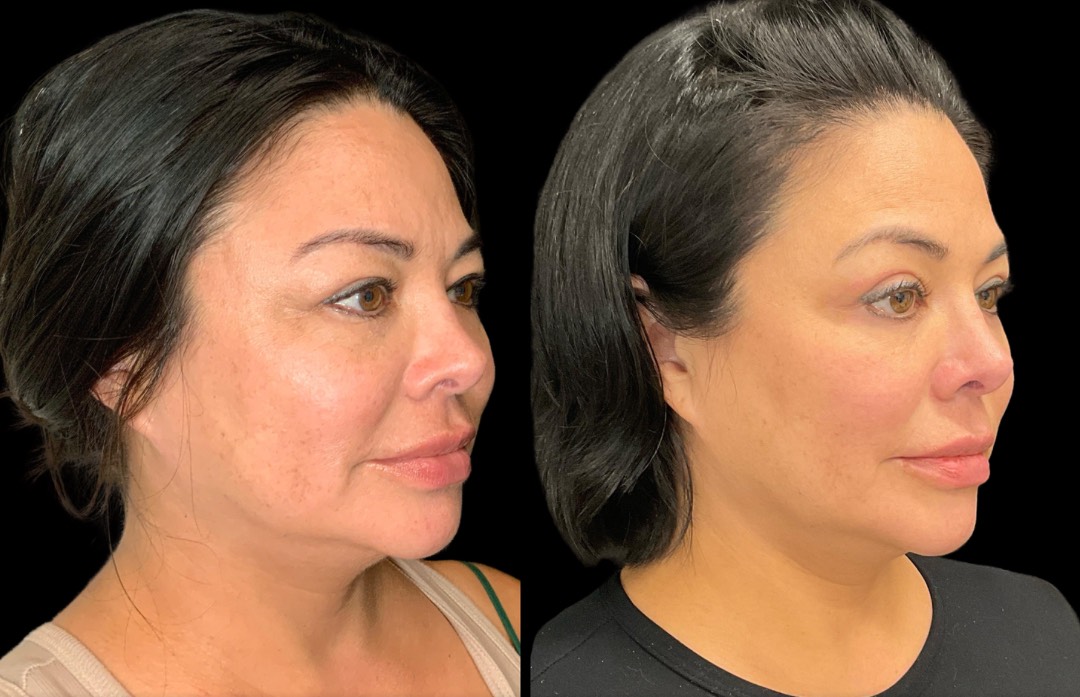 Copy of Untitled Design – 2