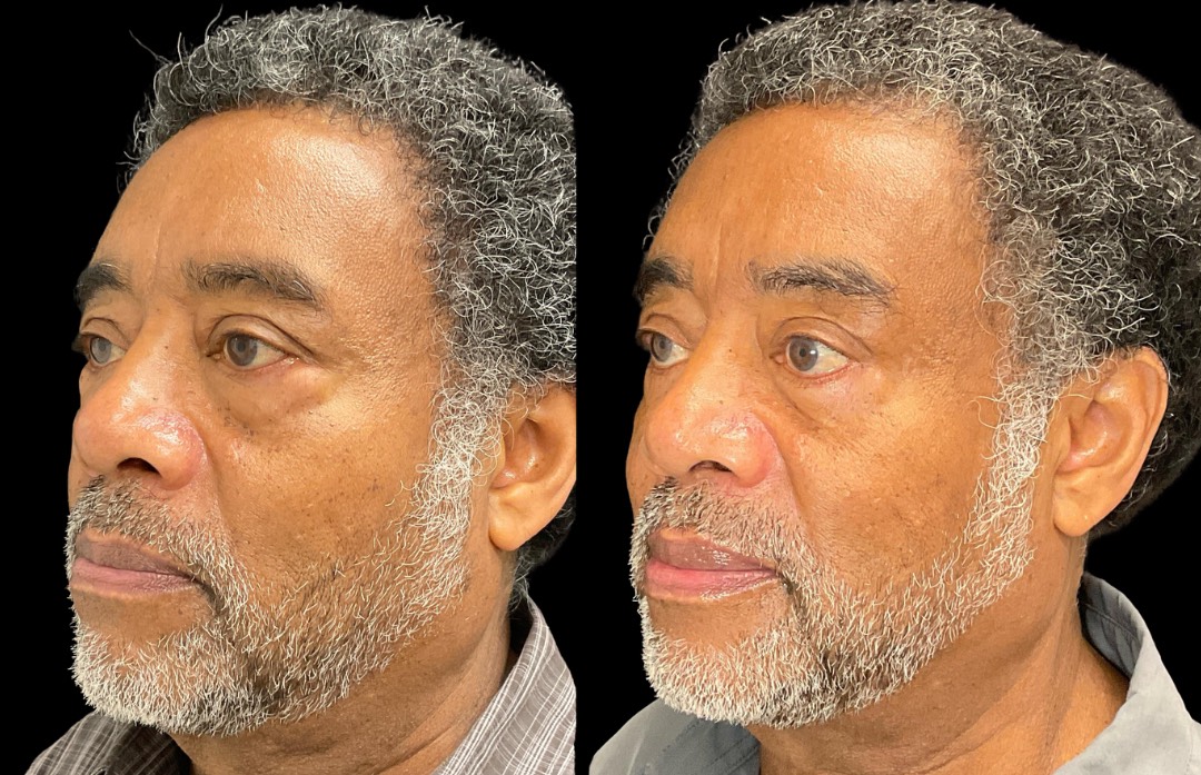 Copy of Untitled Design – 2