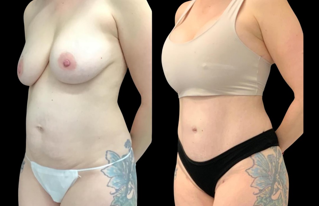 Copy of Untitled Design – 2