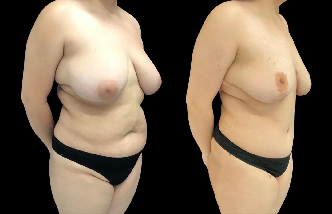 Copy of Untitled Design – 2