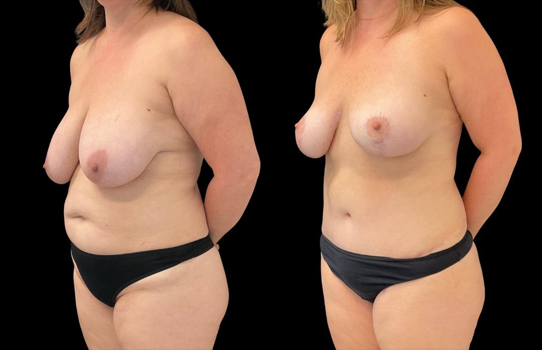 Copy of Untitled Design – 2