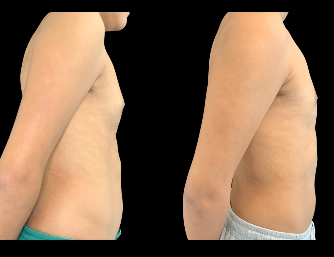 Copy of Untitled Design – 3 (1)