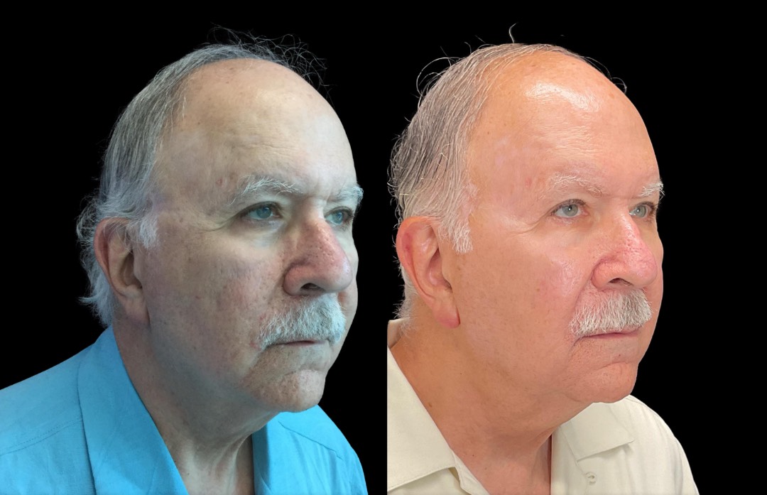 Copy of Untitled Design – 3