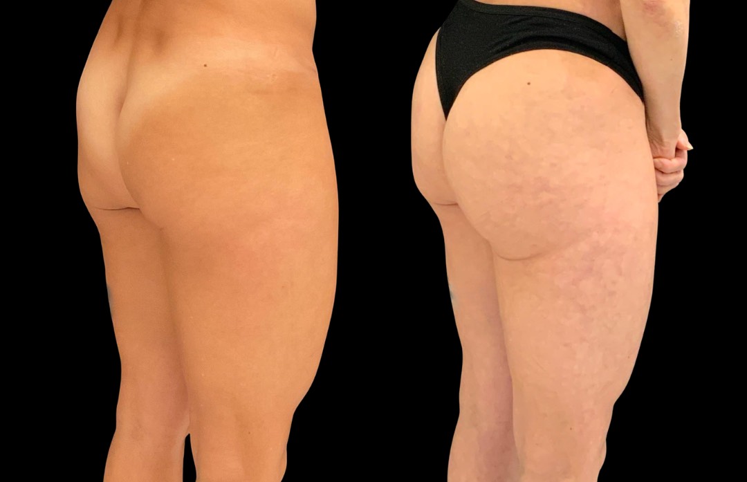 Copy of Untitled Design – 3