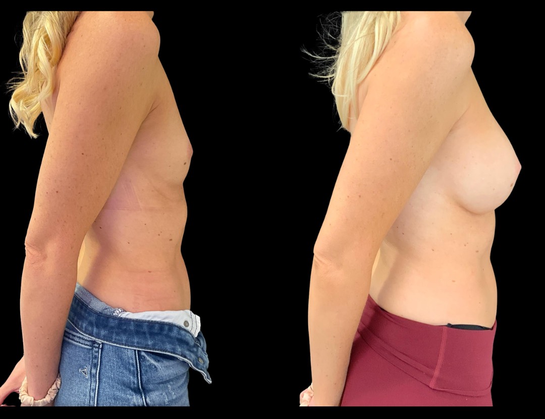 Copy of Untitled Design – 3