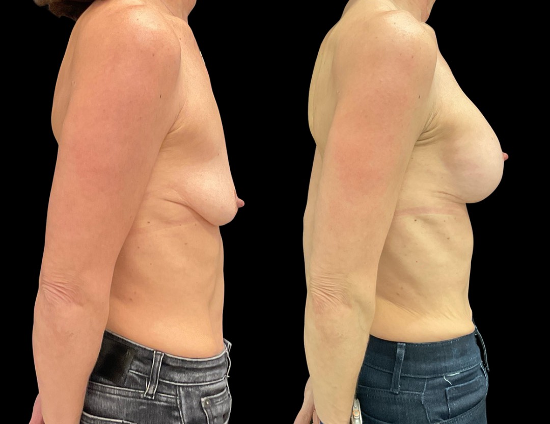 Copy of Untitled Design – 3