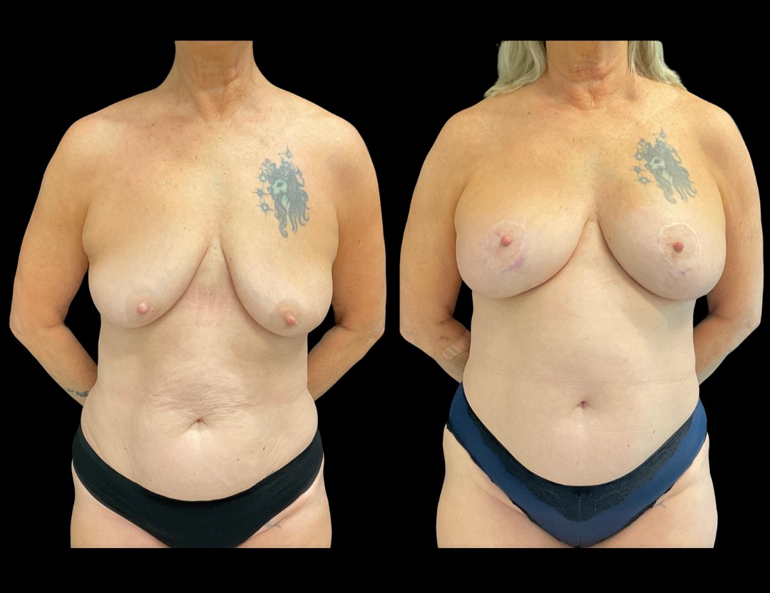 Copy of Untitled Design – 3