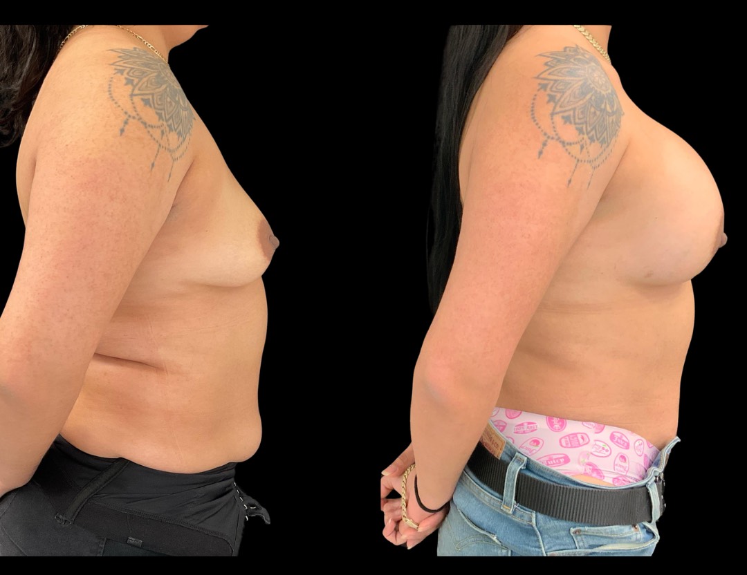 Copy of Untitled Design – 3