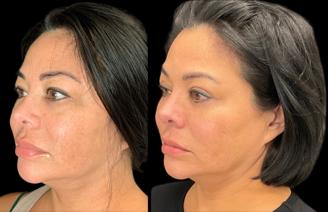 Copy of Untitled Design – 3