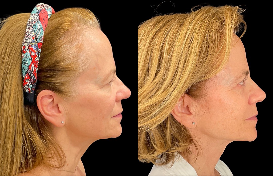 Copy of Untitled Design – 3