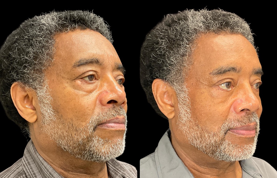 Copy of Untitled Design – 3