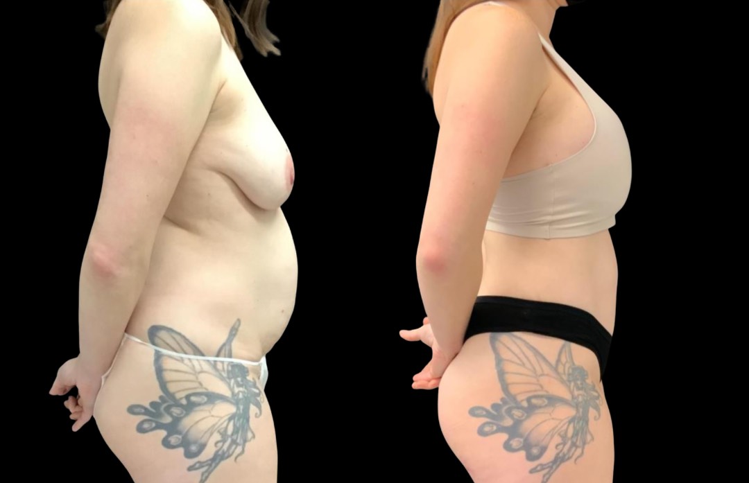 Copy of Untitled Design – 3