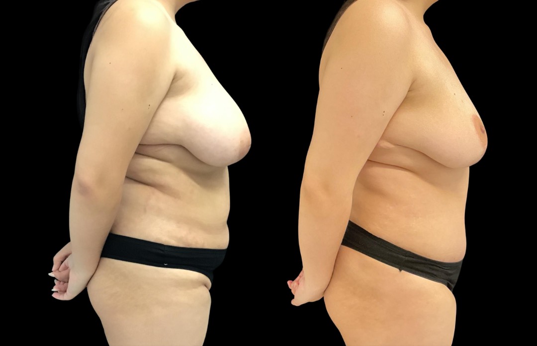 Copy of Untitled Design – 3