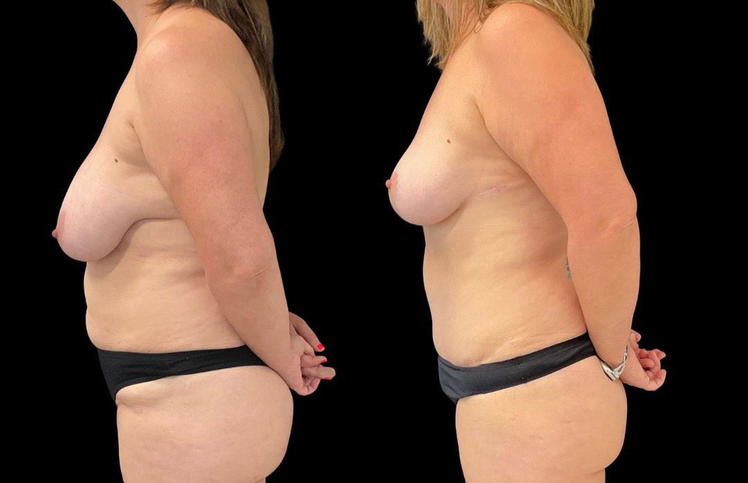 Copy of Untitled Design – 3