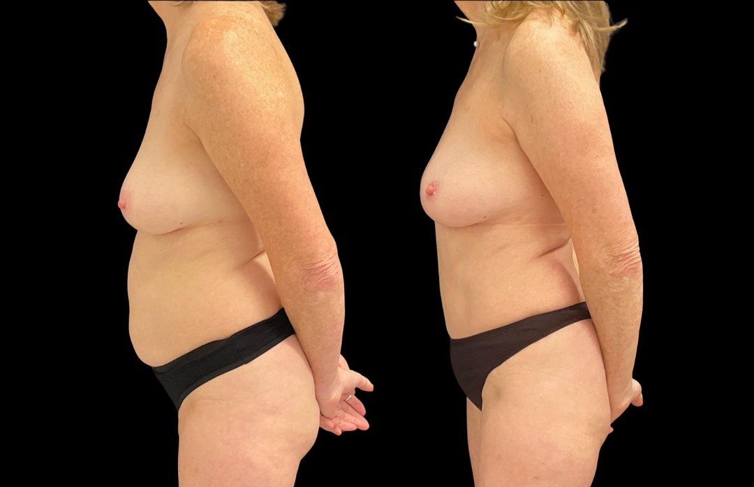 Copy of Untitled Design – 3 – Copy