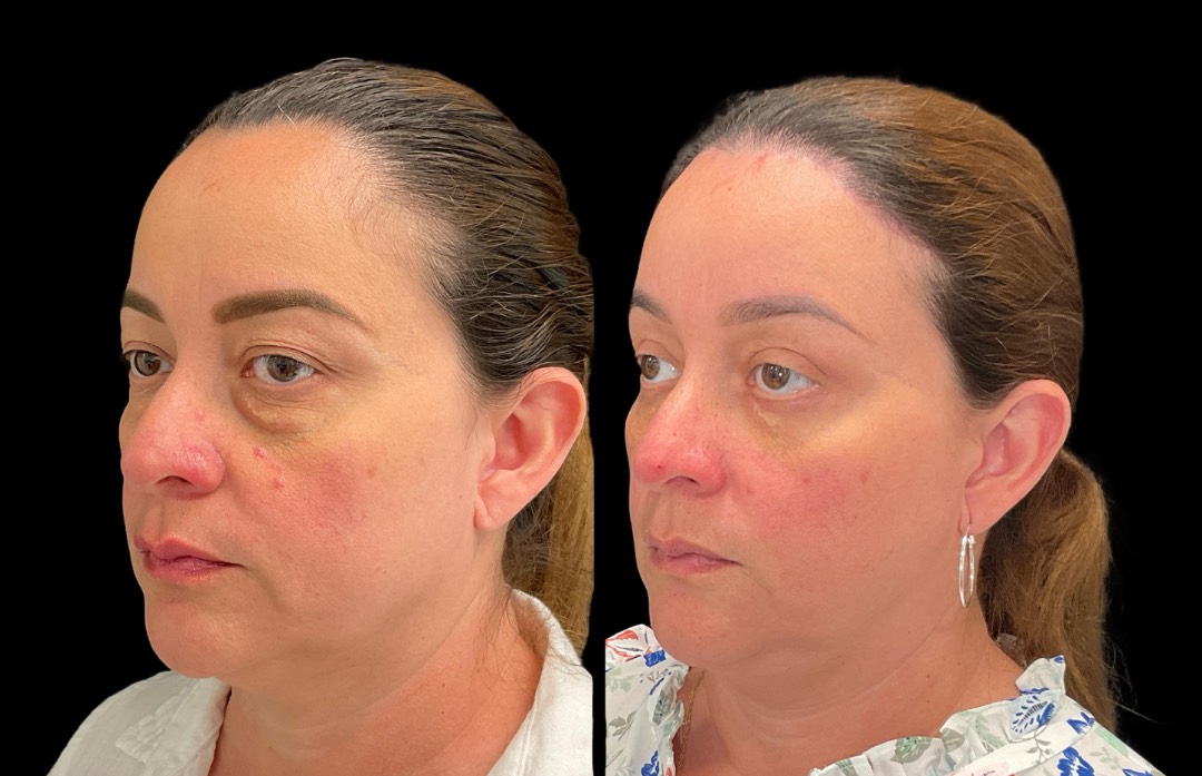 Copy of Untitled Design – 3