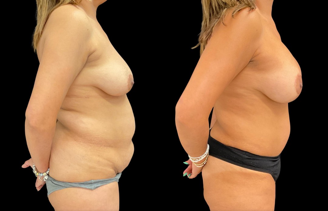 Copy of Untitled Design – 4