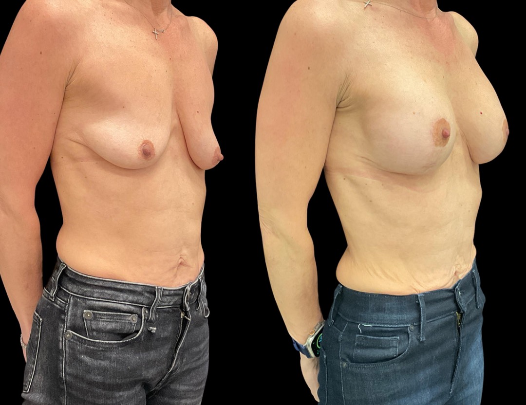 Copy of Untitled Design – 4