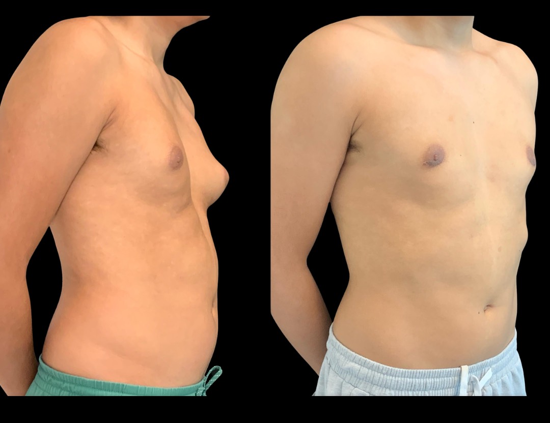 Copy of Untitled Design – 4