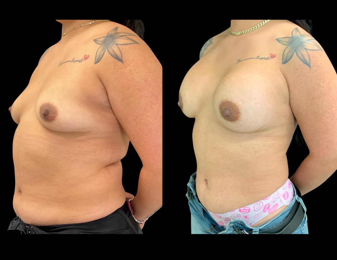 Copy of Untitled Design – 4