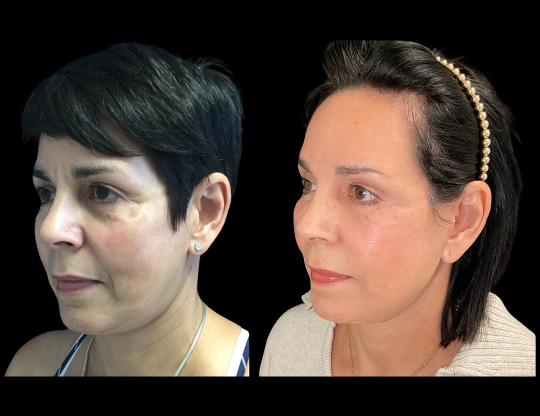 Copy of Untitled Design – 4