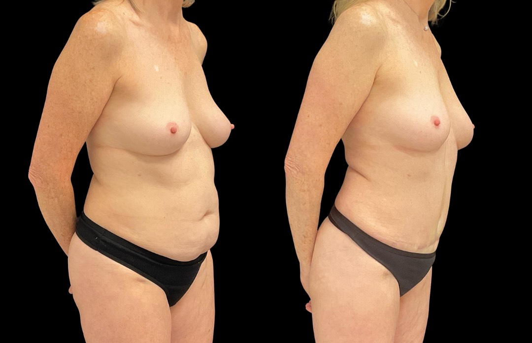 Copy of Untitled Design – 4 – Copy