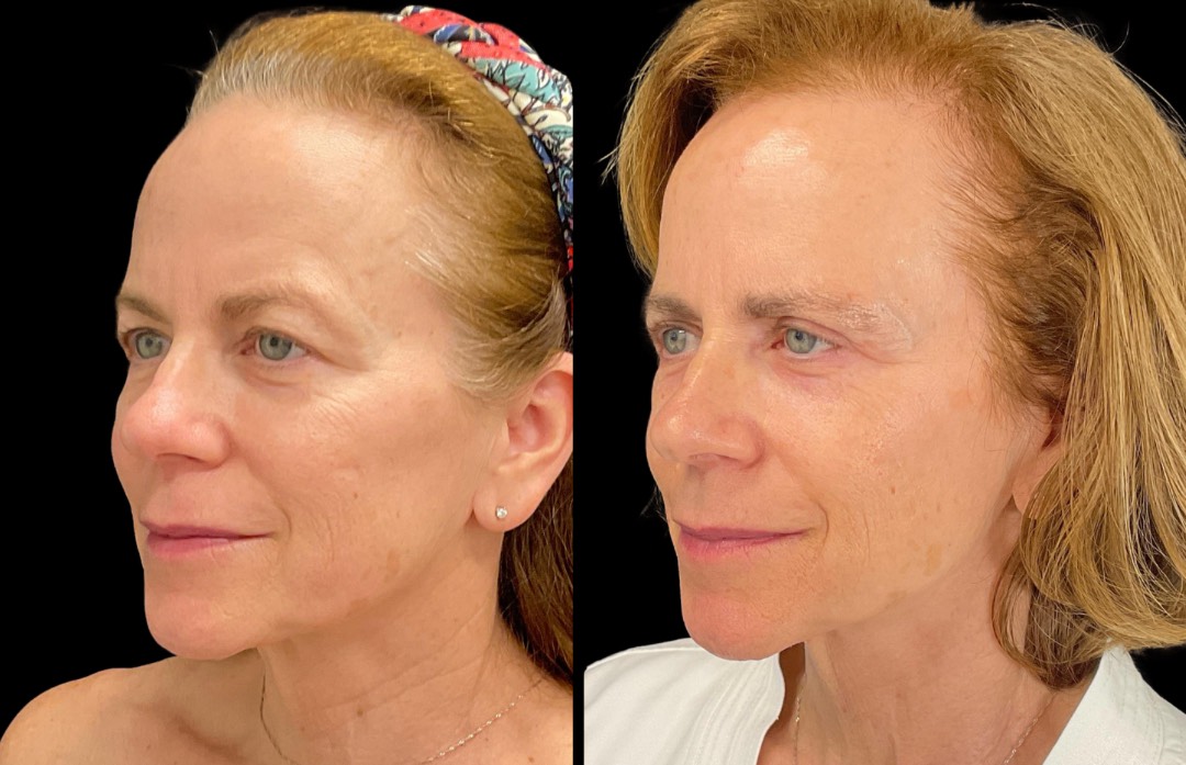 Copy of Untitled Design – 4