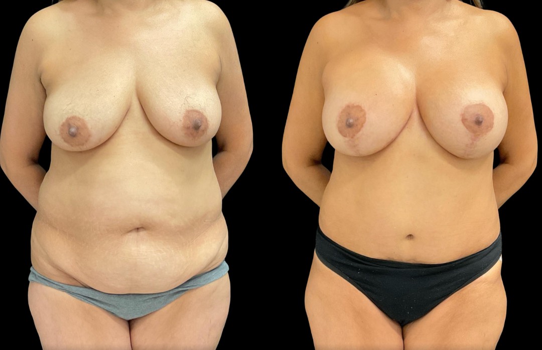 Copy of Untitled Design – 5