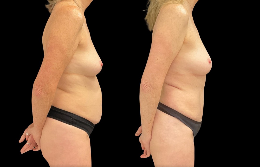 Copy of Untitled Design – 5