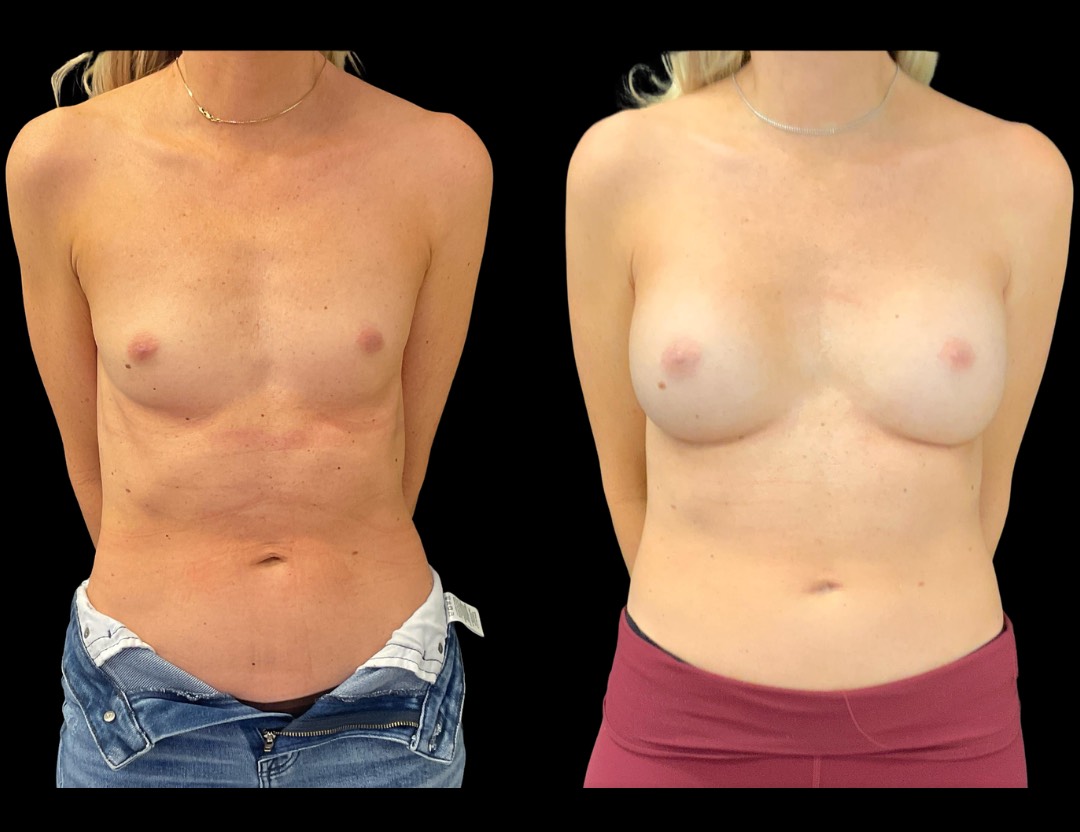 Copy of Untitled Design – 5