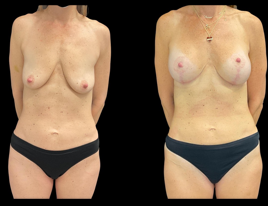 Copy of Untitled Design – 5