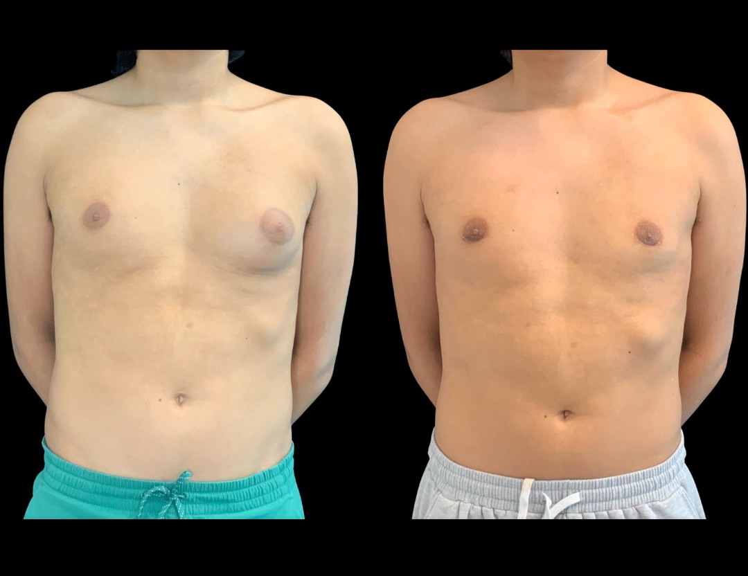 Copy of Untitled Design – 5