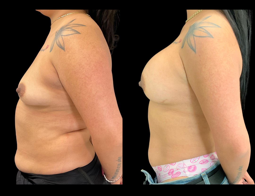 Copy of Untitled Design – 5