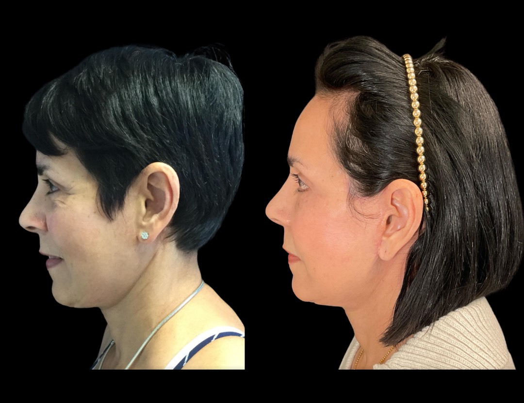 Copy of Untitled Design – 5